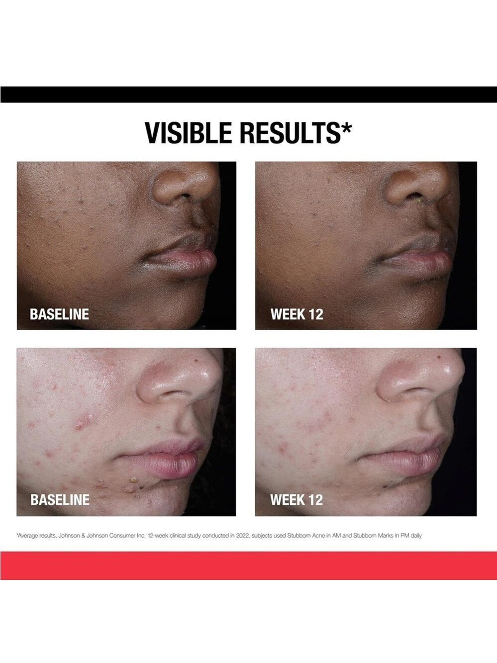 Neutrogena Stubborn Marks PM Treatment - Retinol - Picture 4 of 8
